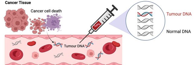 The new blood test can detect small fragments of cancer DNA in stage II colon cancer patients post-surgery. Picture: Walter and Eliza Hall Institute