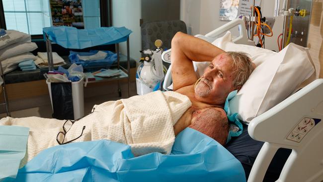 Former Oakbank chairman John Glatz recovering in the burns unit at the Royal Adelaide Hospital. Picture: Matt Turner