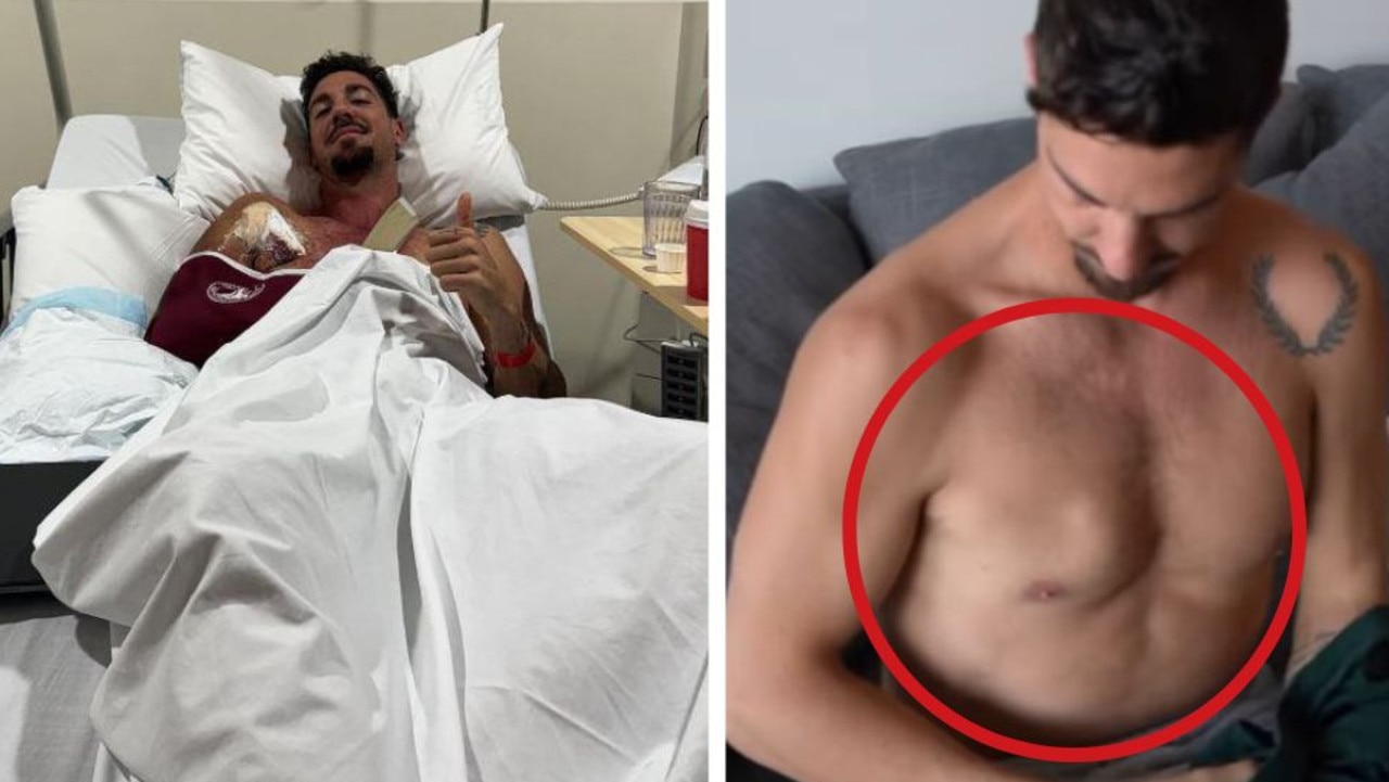 ‘Toughest challenge’: Tennis star’s gruesome injury update