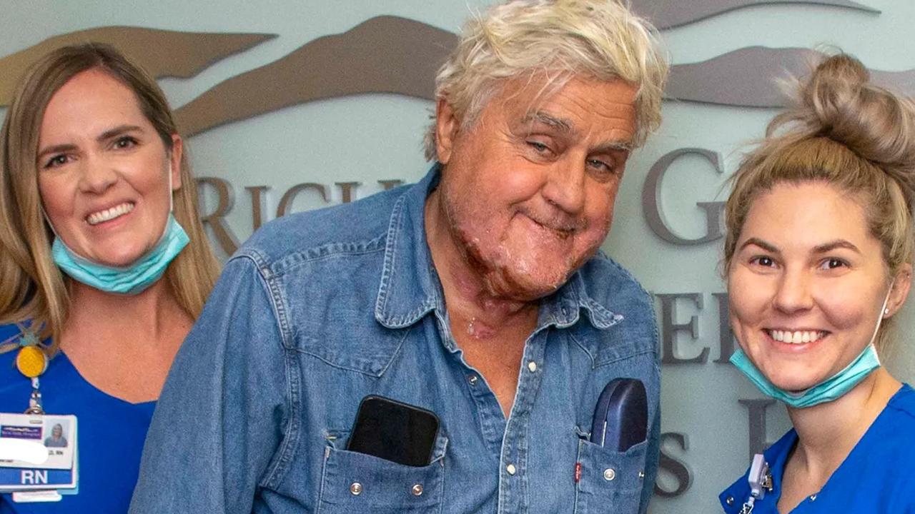 Leno poses with nurses who cared for him after he suffered third-degree burns in a car fire back in 2022. Picture: Grossman Burn Centre