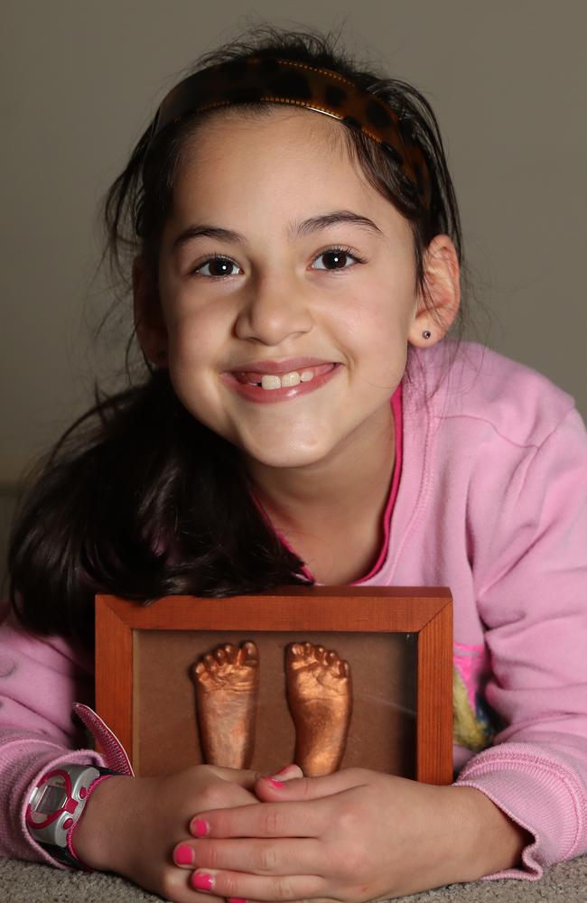 Alicia Terlato holds a cast of her sister Amanda's feet. Picture: Alex Coppel.