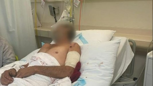 A man has been hospitalised after a dog attack. Picture: 7 News