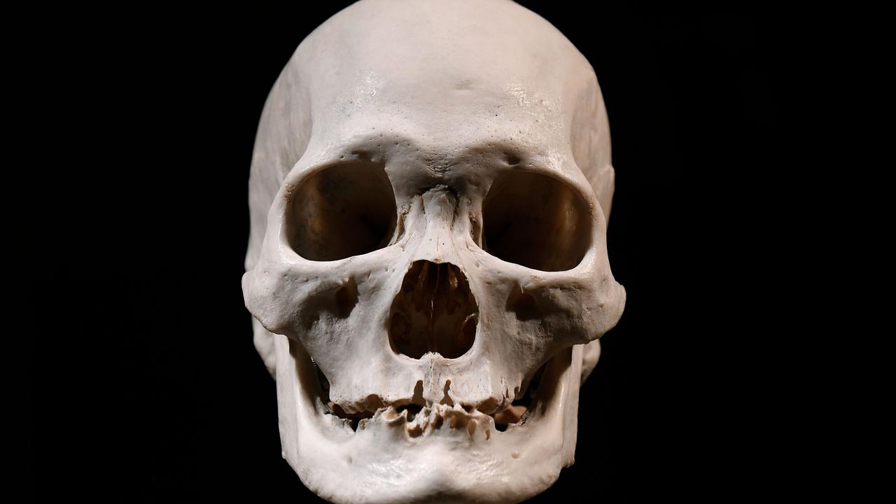 Inherited Human Skull Handed To Sa Police News Com Au Australia S Leading News Site