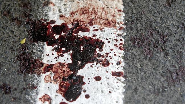Two people have been taken to hospital after being injured in an alleged assault outside the Maryborough Services and Citizens’ Memorial Club.