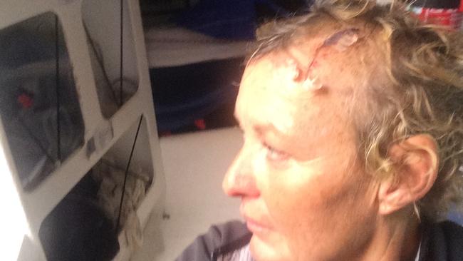 Wendy Tuck after suffering a head injury at sea. Picture; Supplied.