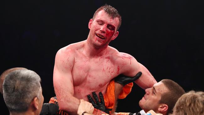 A bloodied Jeff Horn after his fight with Michael Zerafa. Picture: Getty