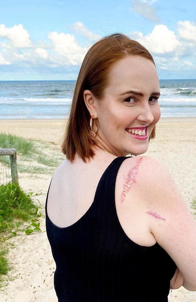 Courtney’s life came crashing down when she was told a seemingly insignificant lump on her arm was aggressive stage 4 cancer.