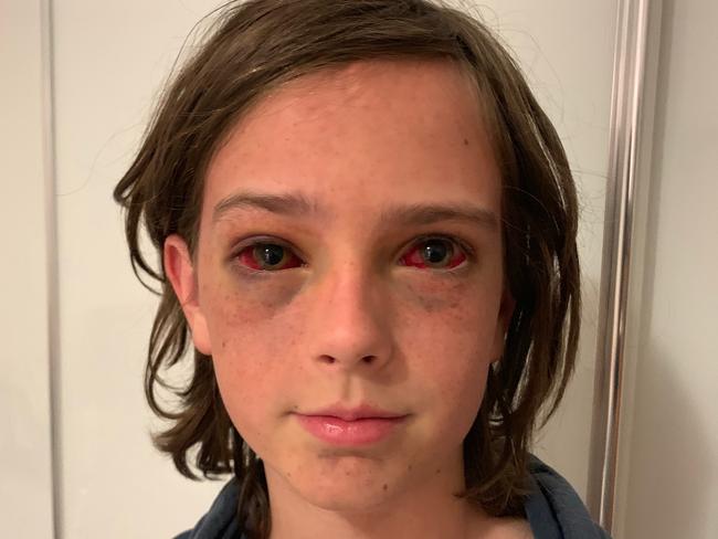 Samuel Whiley, 10, is lucky to be alive, according to his mum. Picture: Supplied