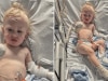 Toddler suffers severe burns from common camping act