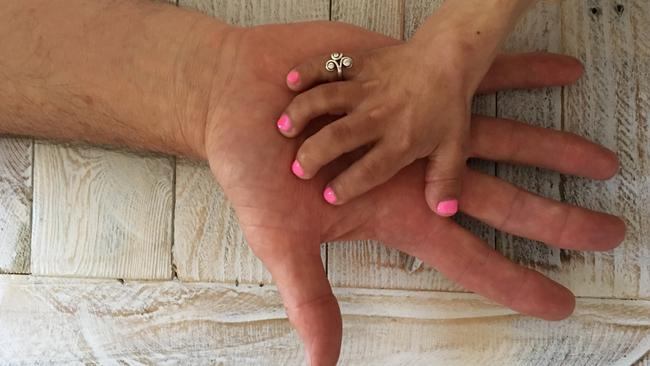 Steve Waugh took this photo of his hand and that of his charity’s ambassador Renee Eliades, 25, who has a rare form of dwarfism.