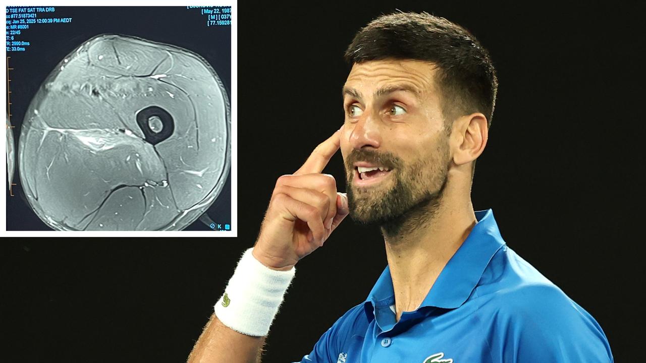 Djokovic claps back at injury ‘experts’ in viral post