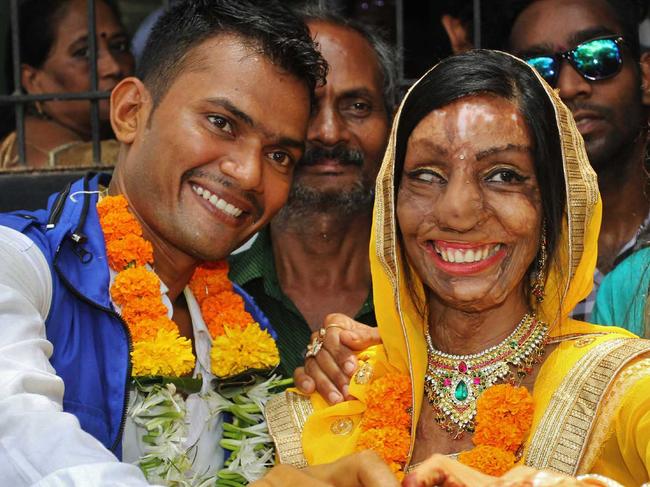 MUMBAI, India - May 23: Acid attack victim Lalita Ben Bansi marries with Ravi Shankar at Thane Registration office, on May 23 2017 in Thane, India. In 2012, Lalita Ben Bansi was attacked with acid by her cousin, who threw it on her over a minor argument. 5 years and 17 surgeries later, she tied the knot with 27-year-old Ravi Shankar. Shankar works as a CCTV operator at a private firm in Kandivli and owns a petrol pump in Ranchi. ?We will decide whether to settle in Mumbai or Ranchi depending on what Lalita wants,? says Shankar. (Photo by Praful Gangurde/Hindustan Times ) *** Please Use Credit from Credit Field ***  Picture: Sipa USA/Splash Australia S