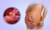 33 Weeks Pregnant- Symptoms and caesarean births