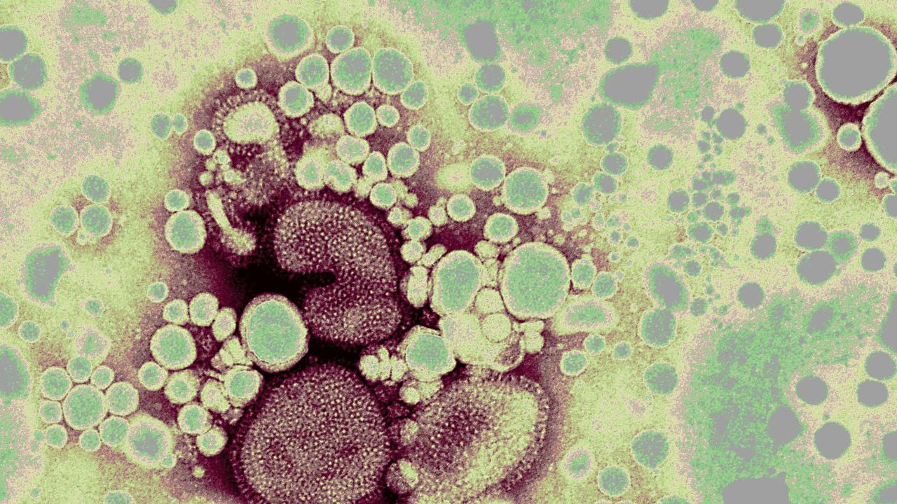 Bird flu virus globules under the microscope. Picture: CSIRO, Livestock Industries Australian Animal Health Laboratory, Geelong