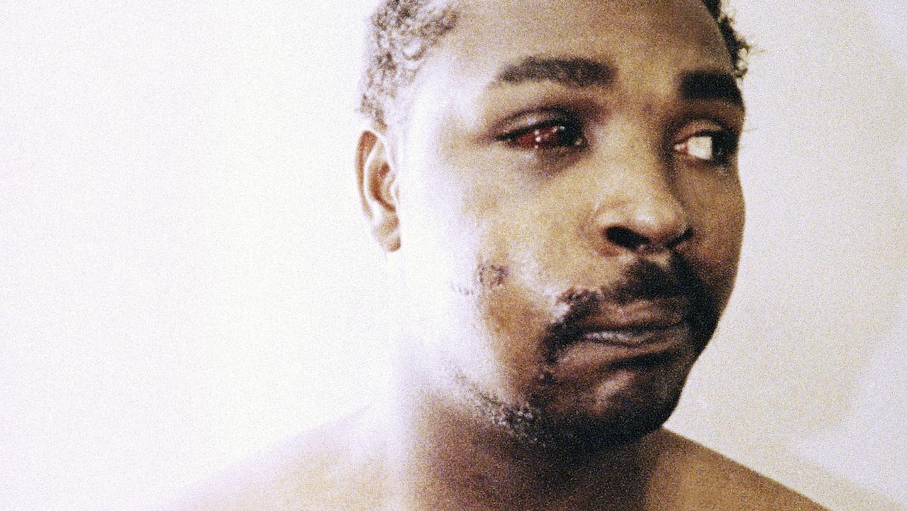 Rodney King suffered 11 fractures in the beating. Picture: AP