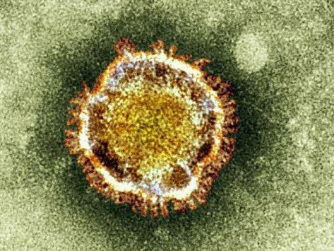 A electron microscope image of a coronavirus. Picture: Reuters