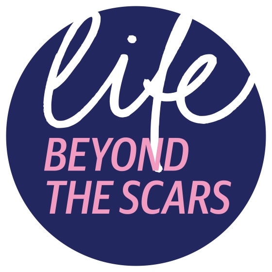 Second instalment in the Daily Mercury’s Life Beyond the Scars series.