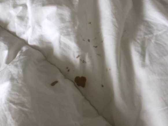 The stains on the doona looked like blood, Hugh de Kretser told the inquiry. Image supplied.