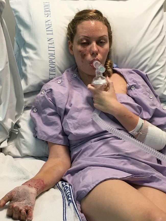 Felicia Djamirze recovering in hospital after the raid.