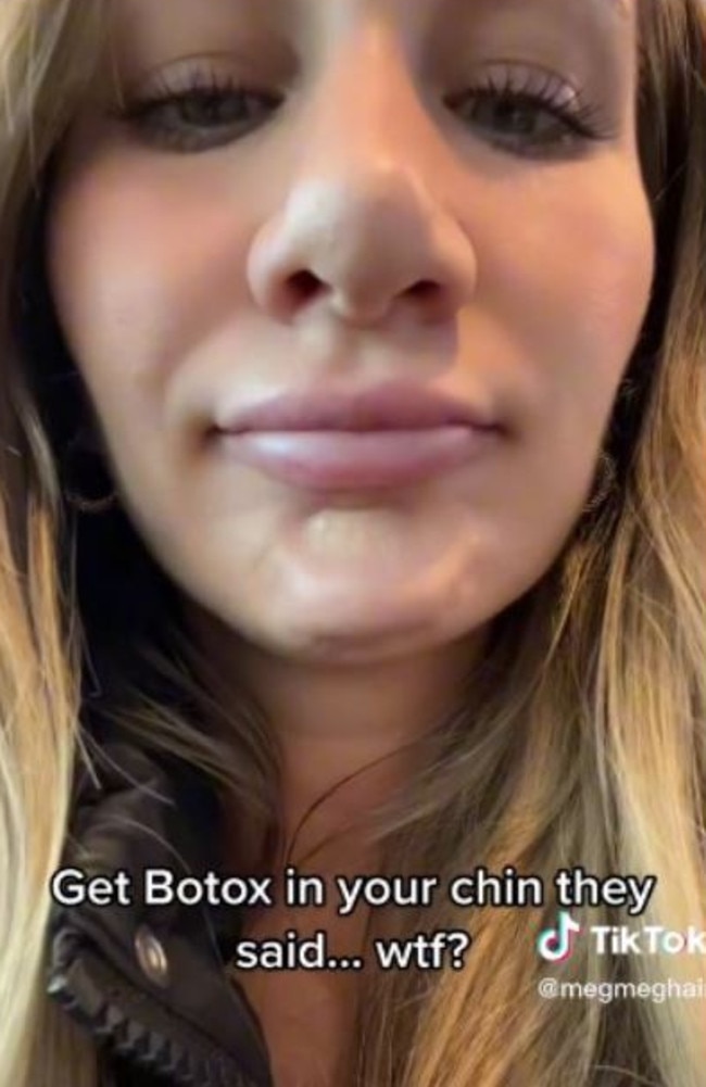 Megan decided to get Botox in her chin. Picture: TikTok