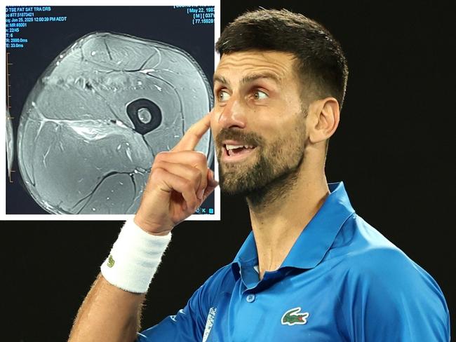 Novak Djokovic claps back at 'experts'