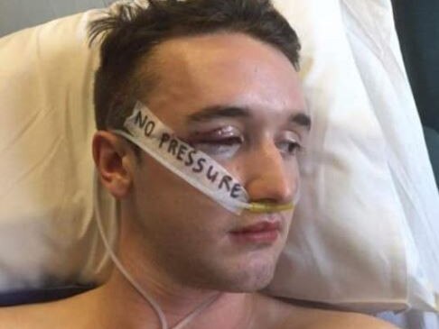Andrew McNab with multiple facial injuries after being attacked at a school leavers celebration in Perth. Picture: Facebook/Andrew McNab