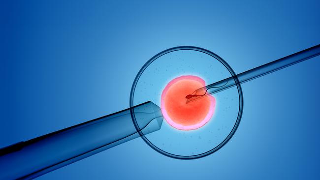 3D rendering of the process in which a single sperm is injected directly into an egg. Picture: File