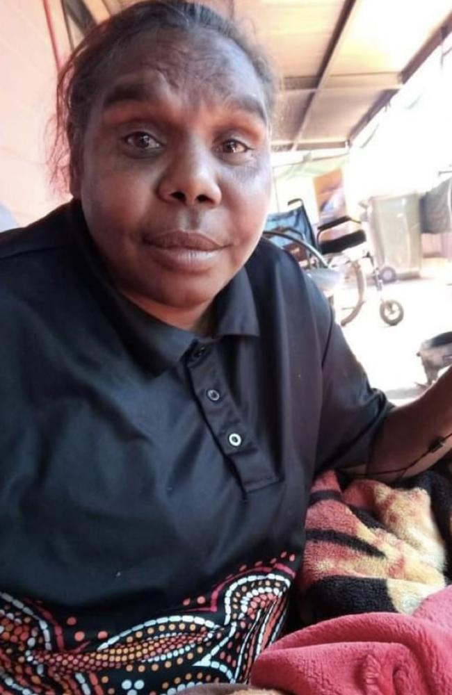 Kumanjayi Napurrurla Dixon, 50, was fatally struck in an alleged hit and run on the Stuart Highway, Coolalinga on May 30, 2022. Her severed leg was later spotted by motorists.