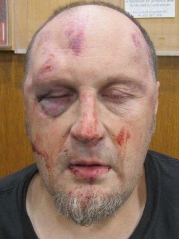 Police say the 50-year-old was left 'traumatised and severely injured'. Picture: Victoria Police