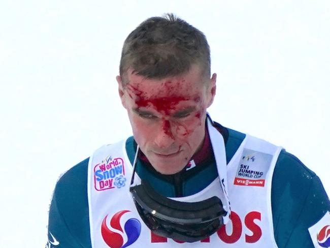 Piotr Zyla of Poland walks away after he has fallen during the FIS Ski Jumping World Cup in Wisla, Poland on November 24, 2019. (Photo by JANEK SKARZYNSKI / AFP)