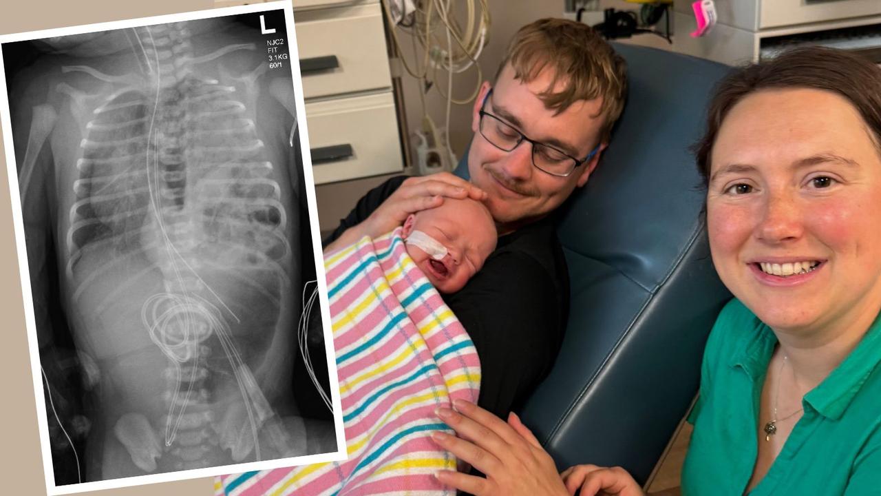 New dad Jamie Woods and partner Jade Curriez and baby Scarlett spent their first Father’s Day at home after being released from The Mater Hospital. The X-ray of Scarlett’s diaphragm. Pictures: Peter Wallis