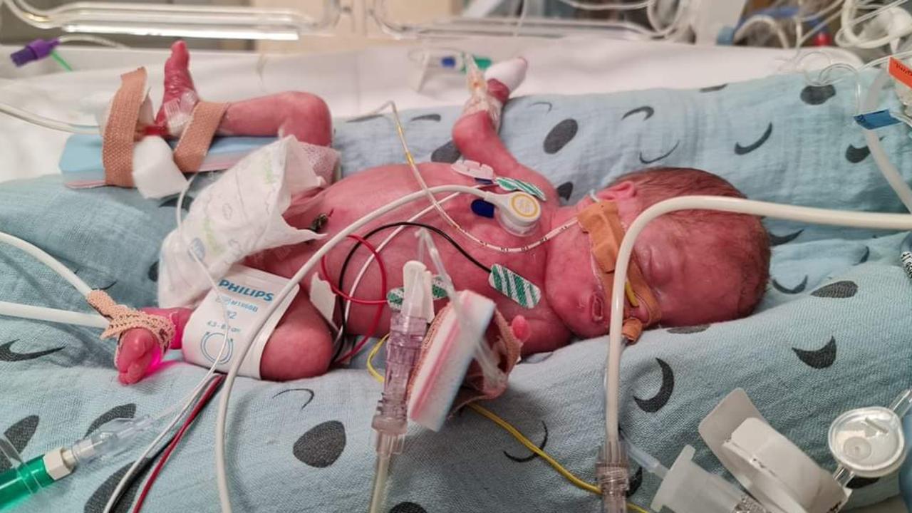 Nikki Worthington gave birth to little Hadrian at 26 weeks. When he was 3 weeks old, he had to have heart surgery. Photo: Supplied