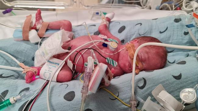 Nikki Worthington gave birth to little Hadrian at 26 weeks. When he was 3 weeks old, he had to have heart surgery. Photo: Supplied