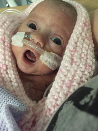 ***ONE TIME WEB USE ONLY*** **CONTACT NETWORK PIC DESK FOR PRINT RIGHTS*** Must credit Caters News/Picture Media PIC FROM CATERS NEWS - (Pictured: Baby Ava born 14 weeks premature but thankfully survived with the help of Mr Men ) Meet the baby girl who was saved from a life-threatening condition by a MR MEN book. Tiny Ava Allen wasnt expected to survive after being born 14 weeks premature, with a rare lung condition, and needed an emergency operation to stand any chance of pulling through. Doctors warned her worried mum, Vicki, 20, that no child as young as Ava had ever survived the surgery - but as baby Ava lay recovering from the op, her mum began to read her a Mr Men book - and was amazed as the sound of her voice steadied her daughters heart rate. Ava Allen, now nine-months-old, has fought against all the odds to still be fighting fit today but her mum Vicki and dad Chris Hutcheson, 21, think its all down to the Mr Men. Vicki, 20, from Horley, Sussex, said: All I wanted to do was pick her up and cuddle her, she was so small and fragile, but she was too small to hold. SEE CATERS COPY