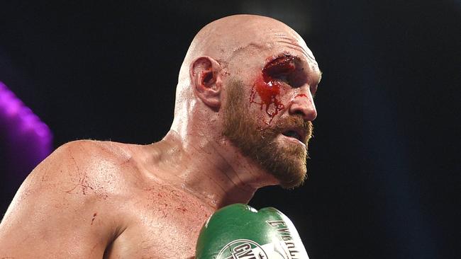 Fury says the toughest opponent of his career is one he can’t see.