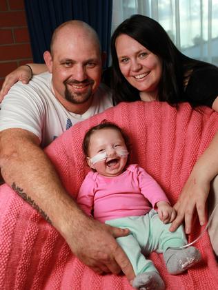 Oculo Dento Digital Syndrome: Whyalla baby Amelia Hampton’s rare ...