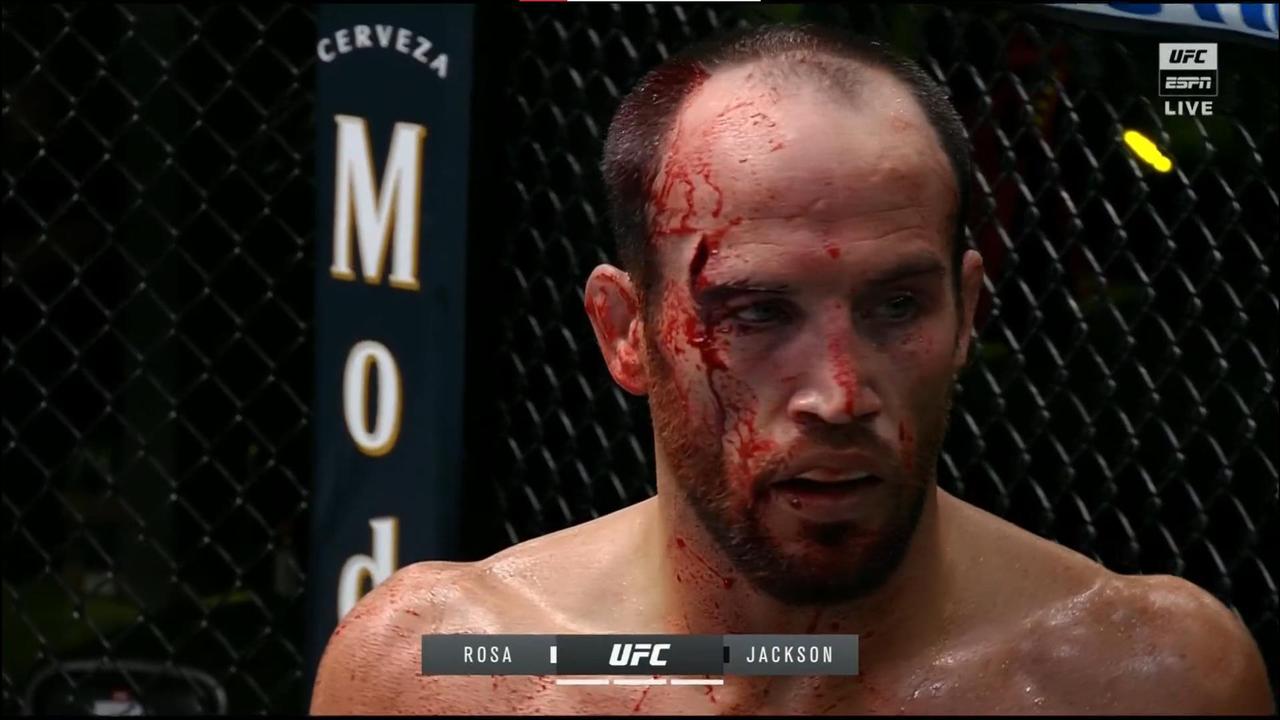 UFC star Damon Jackson survived a terrible cut to beat Charles Rosa.