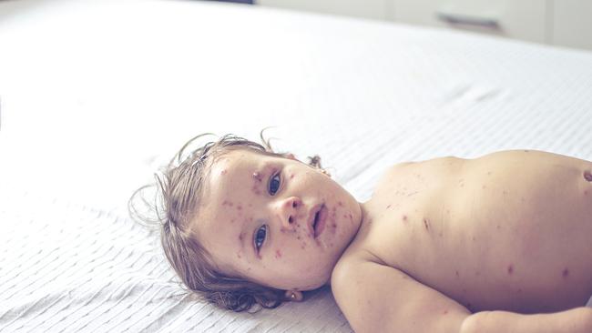 Unvaccinated infants are most at risk. Picture: iStock