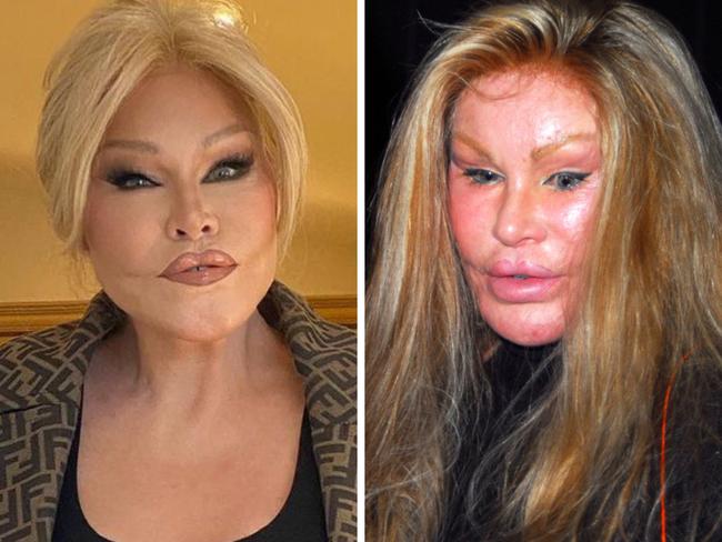 Plastic surgery 'Catwoman' Jocelyn Wildenstein.