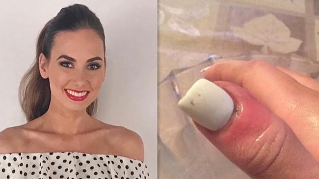 Karolina Jasko spotted a thin purple line on her thumbnail that turned out to be cancer.