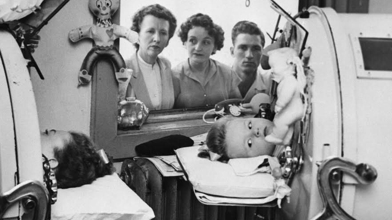 Two little girls inside iron lung machines while being treated for polio in Memphis, Tennessee. The first iron lung was used on this day in 1928.