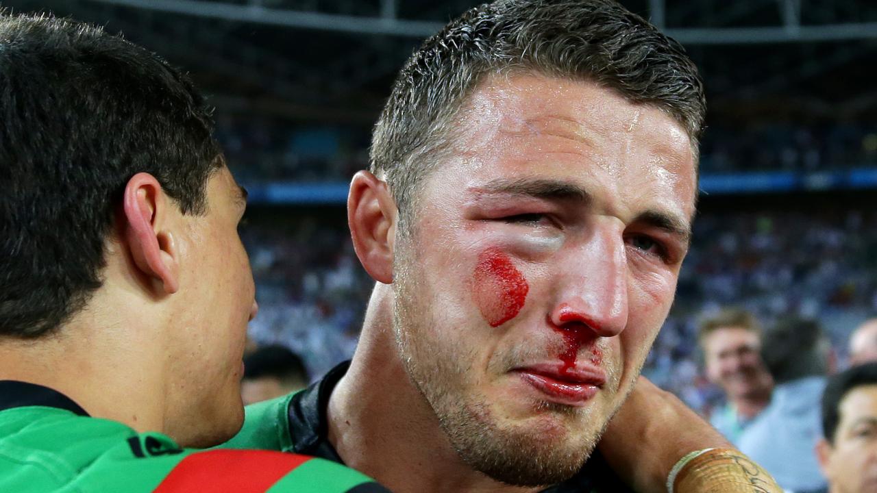 Sam Burgess celebrates the 2014 Grand Final win with a fractured eye socket and cheekbone.