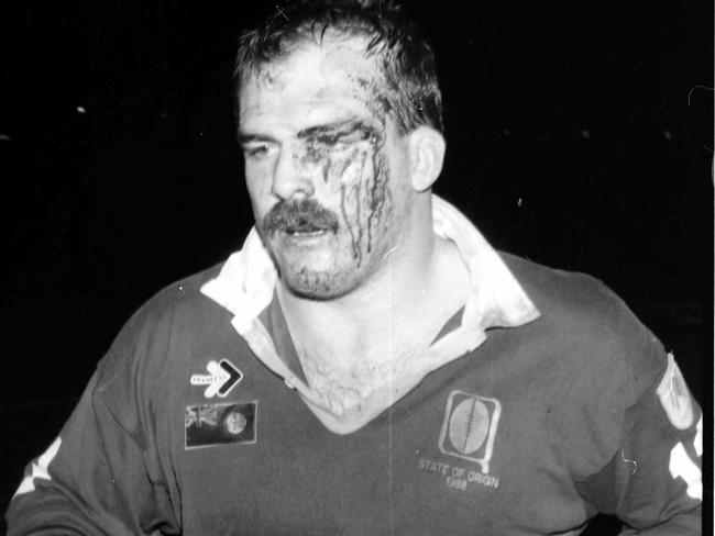 May 31, 1988, State of Origin game two at Lang Park. Queensland's Martin Bella heads for halftime treatment to a cut eyebrow. The Maroons would win 16-6. Picture: Jim Fenwick/Courier Mail