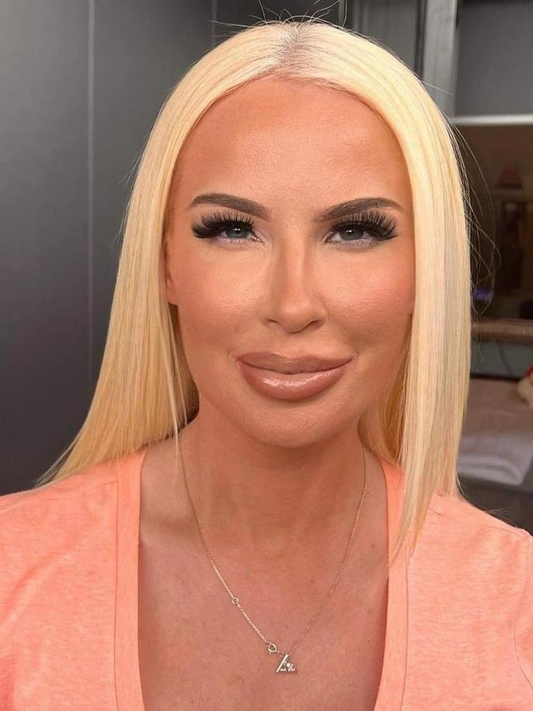 Botox queen Juliet Young is facing court for intimidating a former worker. Picture: Supplied