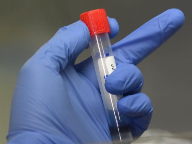 CORONAVIRUS - RAH. Kristy Robinson, Medical Scientist with SA pathology, in the lab with a deactivated specimen of coronavirus preparing the sample for testing in the Virology Lab at SA Pathology Royal Adelaide Hospital. Picture: Tricia Watkinson