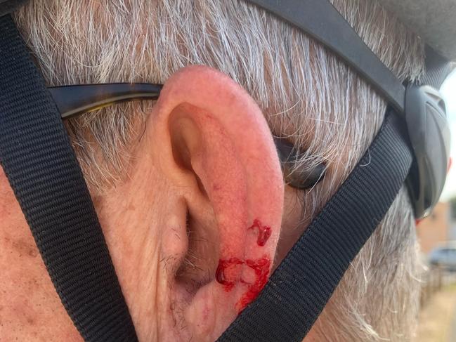 Christiaan was left with a bloodied ear in another Magpie attack