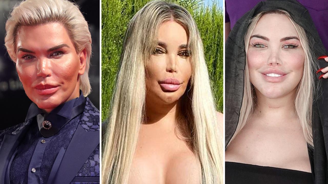 zwemmen Aftrekken Mededogen Former human Ken doll unrecognisable in photos after extreme plastic  surgery | news.com.au — Australia's leading news site