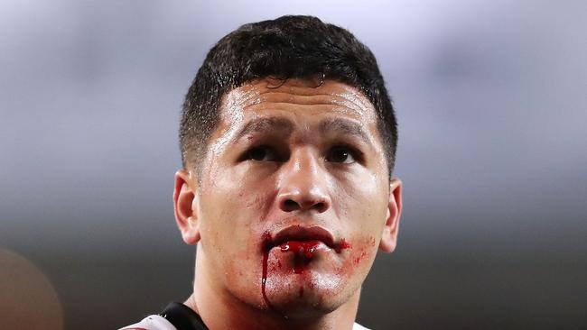 Dallin Watene-Zelezniak of the Panthers bleeds from the mouth during the NRL Elimination Final match against the Manly Sea Eagles.