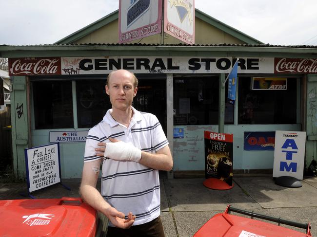 Steven Van Meeteren pictured in 2010 shortly after he was attacked in a separate incident.