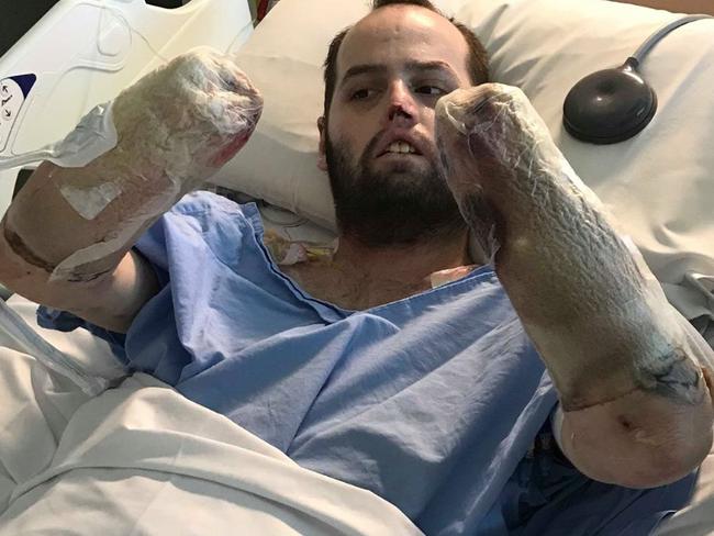 Jake Clift, in hospital following his amputations. Picture: Gofundme